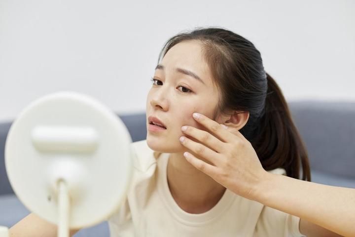 後天性敏感肌。