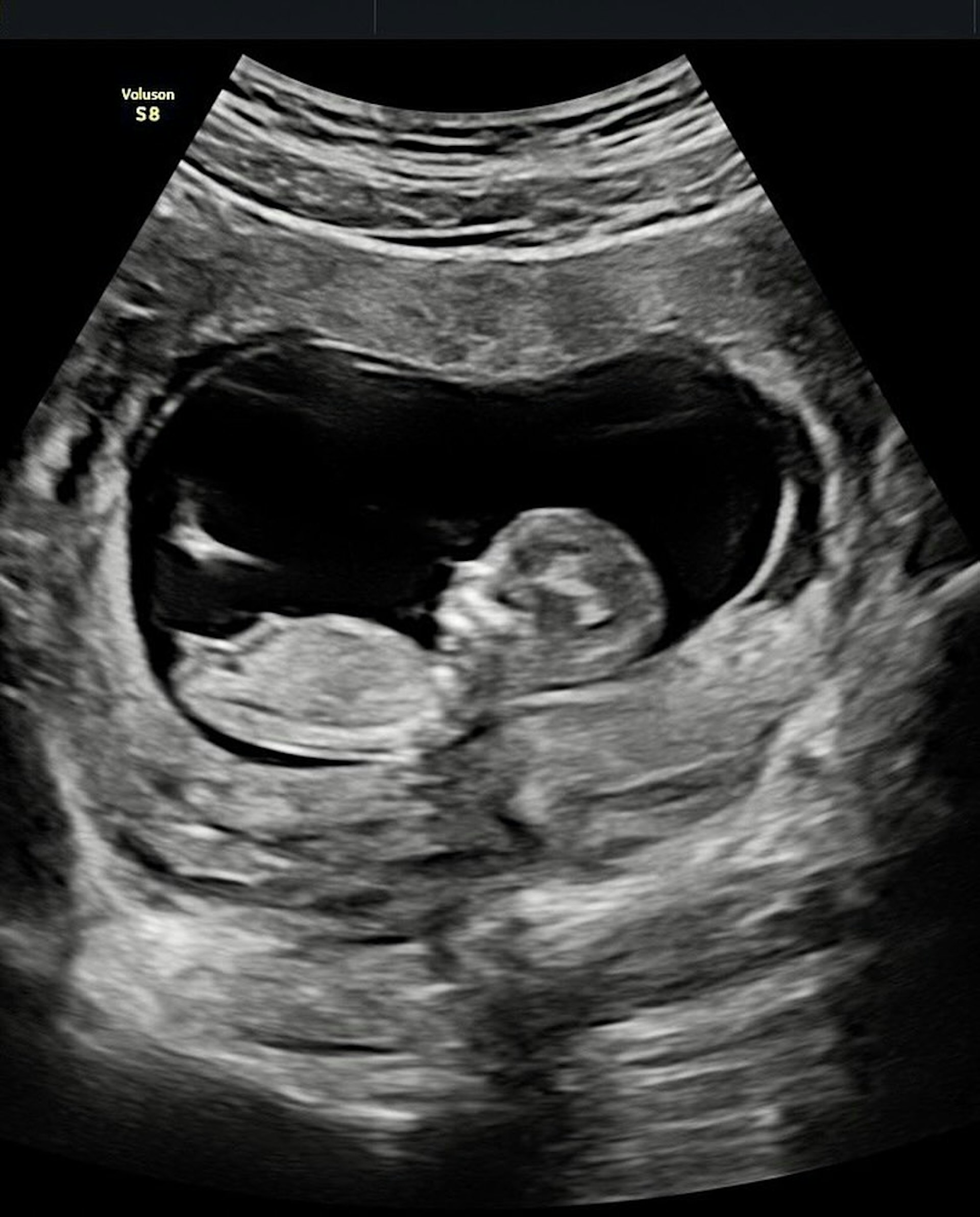 阿嬌前夫賴弘國再度當爸爸！