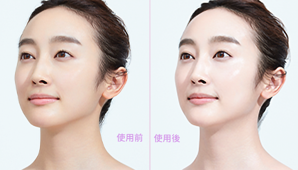 臨床實證88%用家認同2星期減淡色斑^，膚色更淨白剔透～