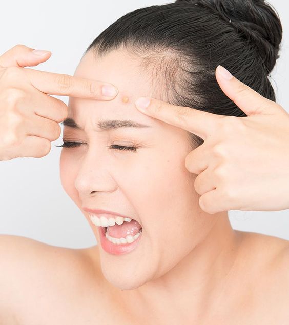 額頭生很多暗瘡及和暗粒?