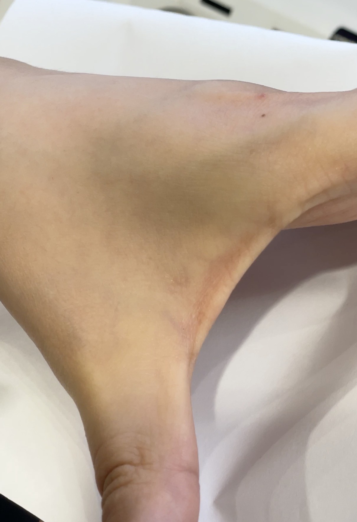 遮毛孔效果:精準地修飾局部毛孔,皮膚明顯變平滑。