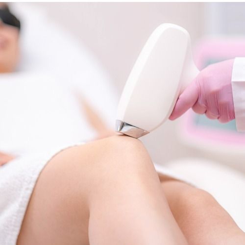 HIFU 超聲波減肥機。