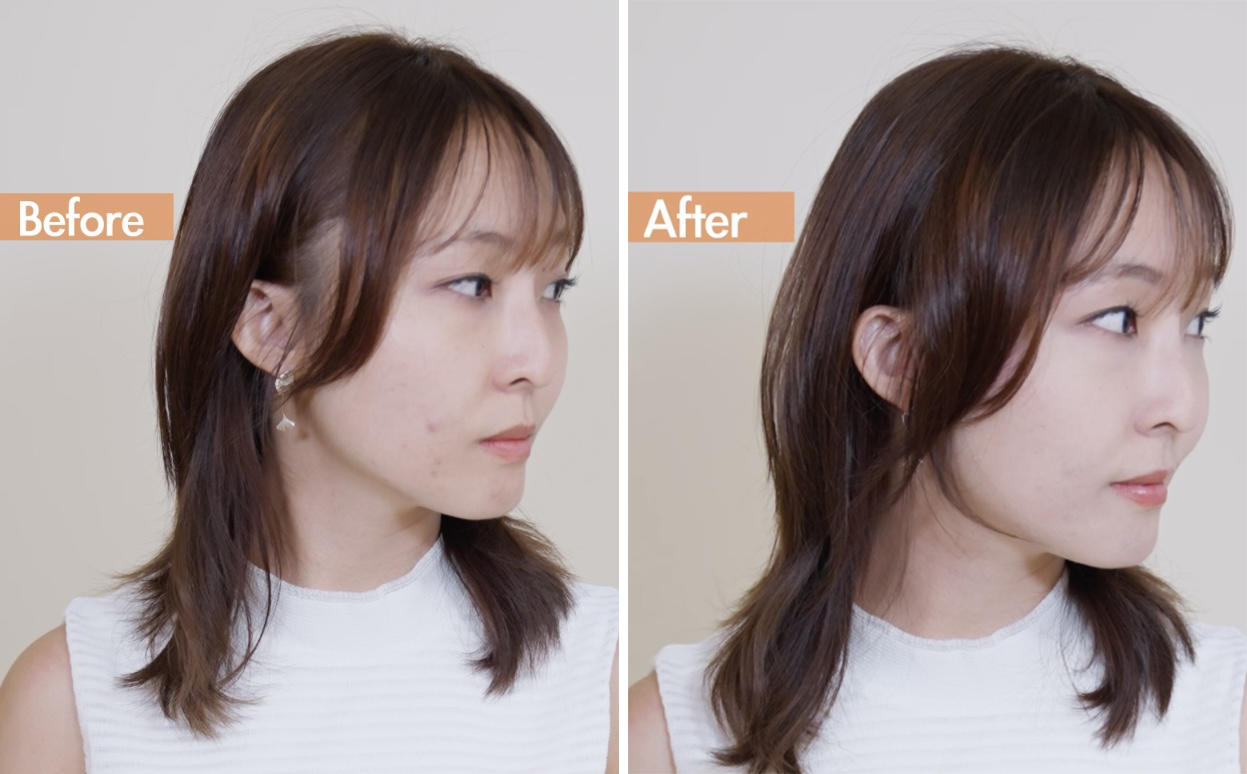 真的有效改善我的皮膚困擾！