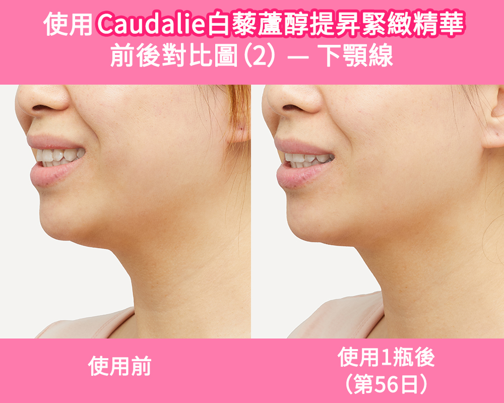 香港用家使用Caudalie膠原精華1瓶（56日）後，V面效果相當滿意。