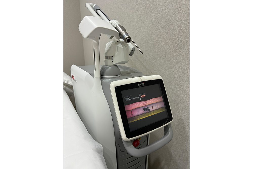 Fotona能擊退黑色素斑點,嫩膚效果滿意。