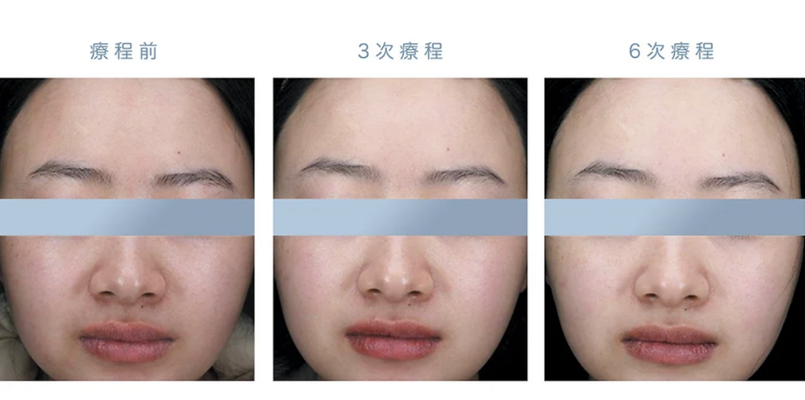 美白功效是肉眼可見！