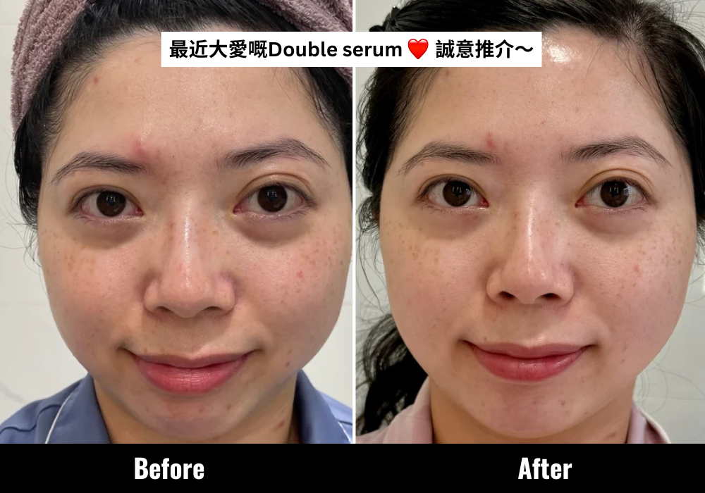 真實用家分享:全新第9代Double Serum超快吸收,潤而不笠。