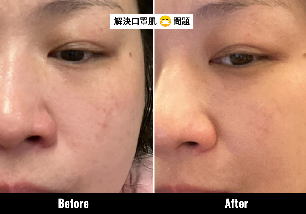 CLARINS全新第9代Double Serum助Meo解決內乾外油的肌膚問題,