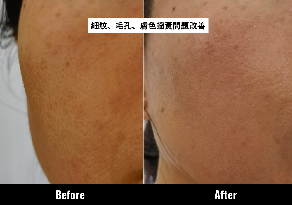 CLARINS全新第9代Double Serum有助提亮膚色,改善暗沉蠟黃問題。