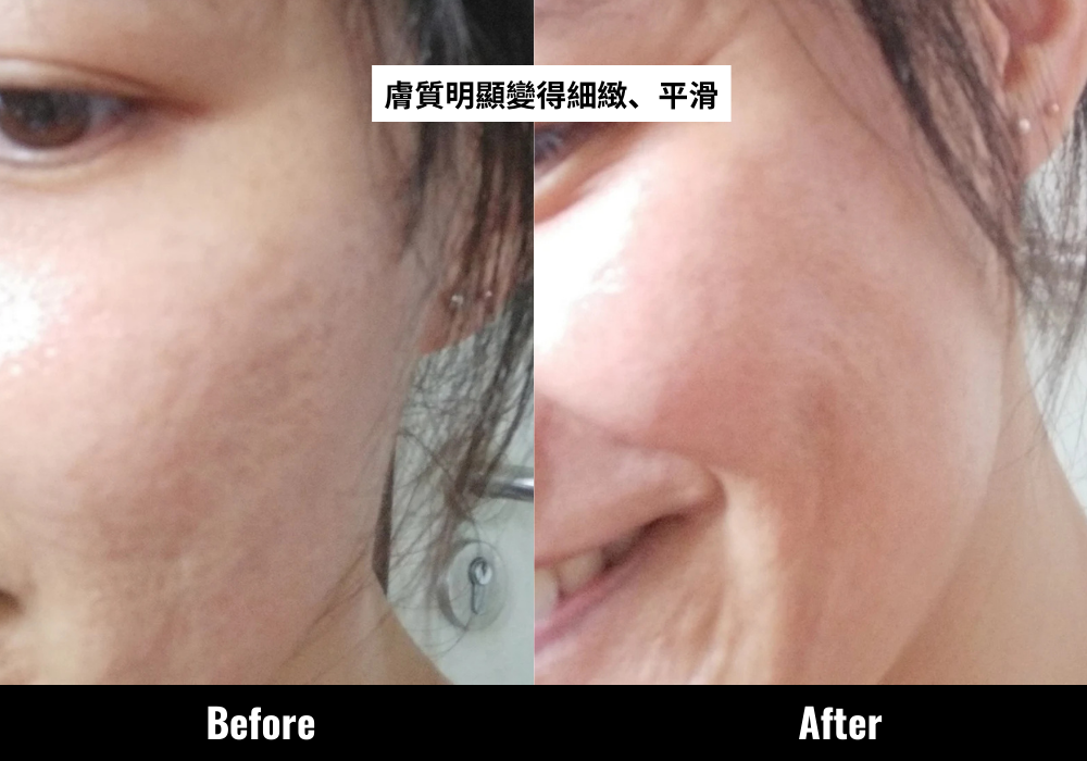 因遇上CLARINS全新第9代Double Serum,Bee不再被人叫「阿姐」。