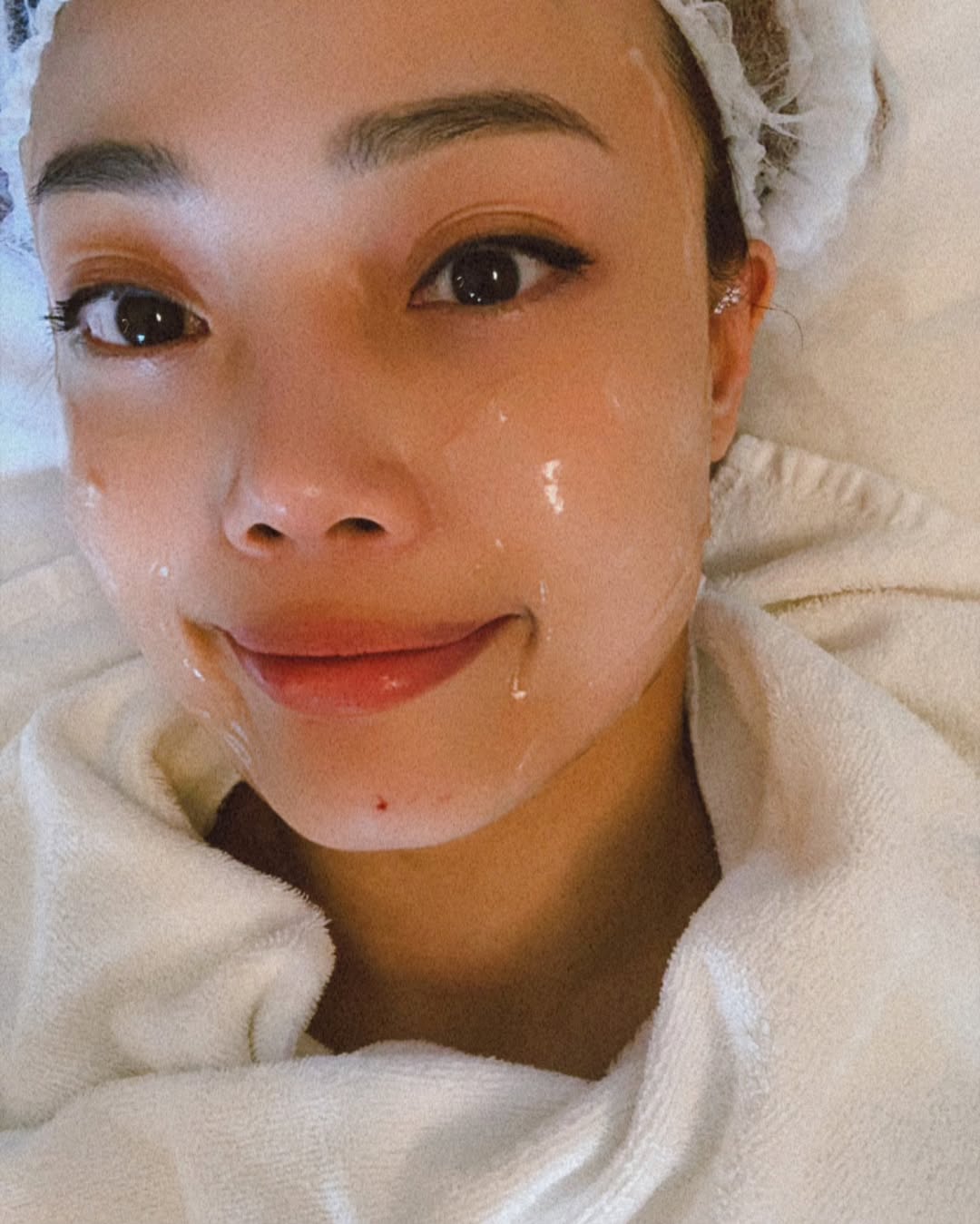 透明質酸是熟齡肌保濕抗老神器！