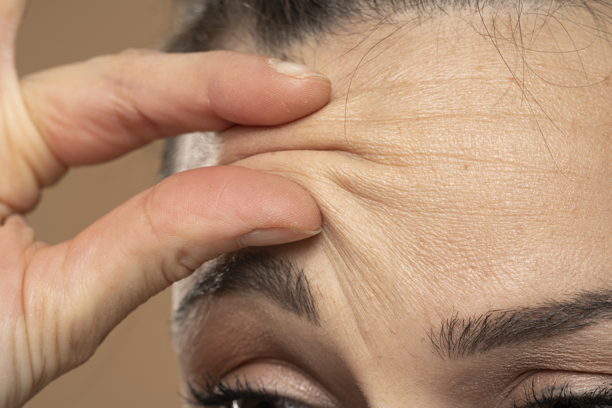 抬頭紋一般分為「動態紋」和「靜態紋」,成因不同,改善方法也不同。