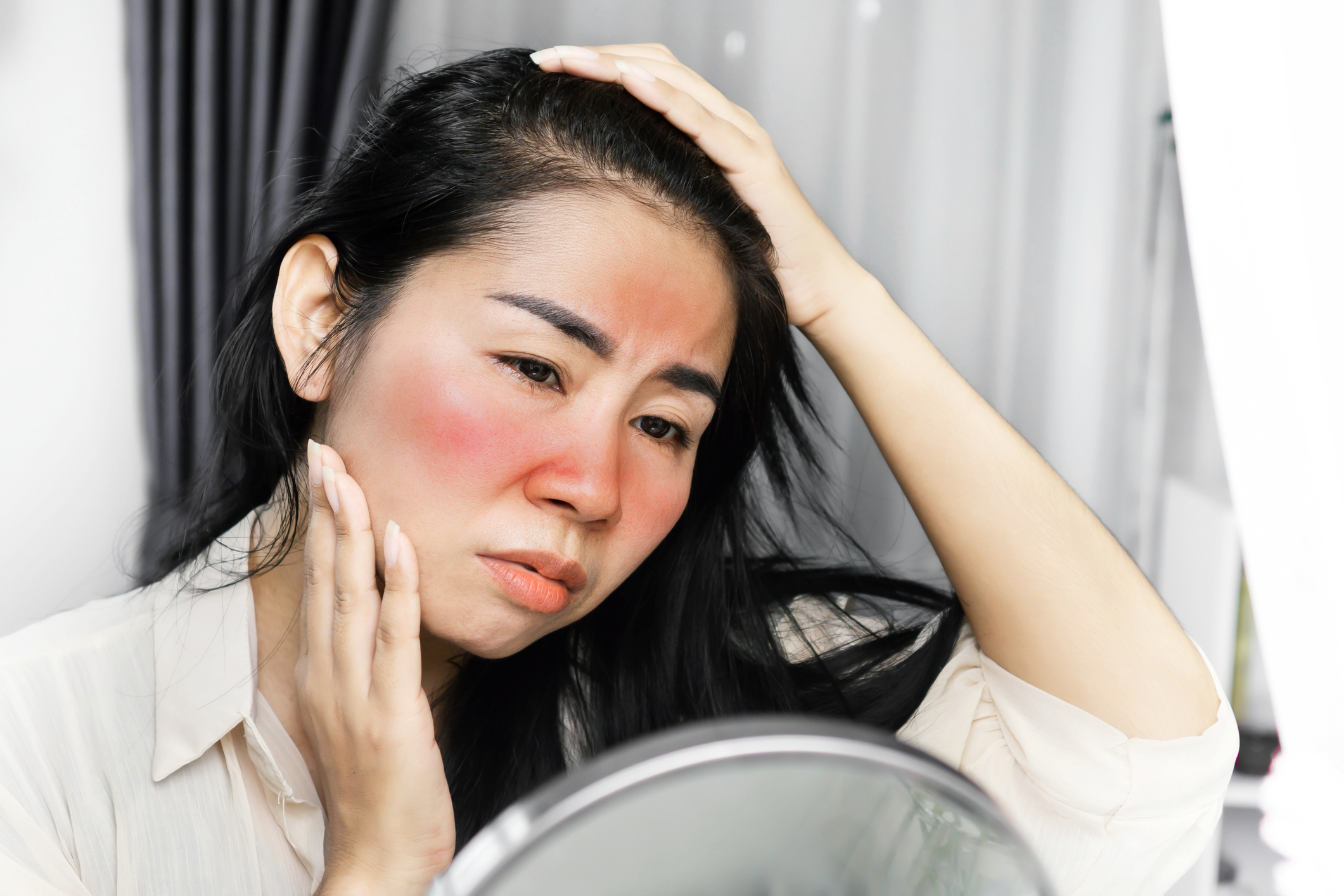 敏感肌常見的情況包括泛紅、乾燥、發癢