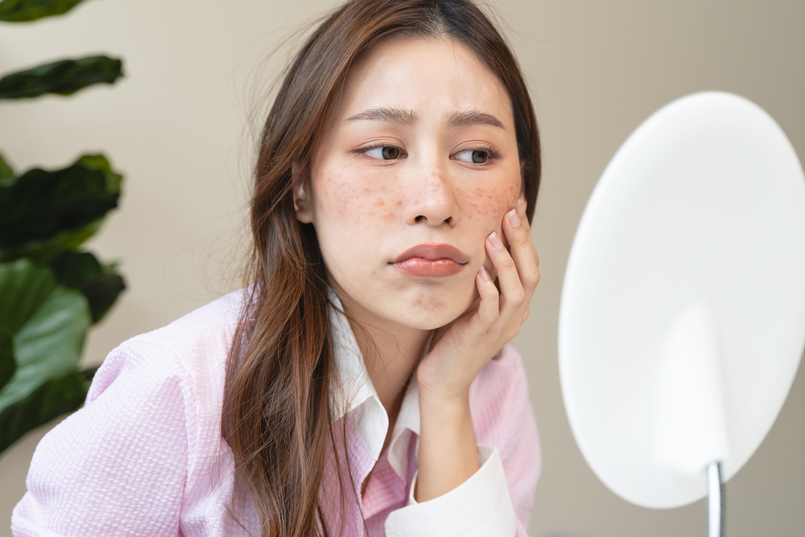 有些人因為膚質、體質或生活習慣不同,更容易成為色斑的「目標」。