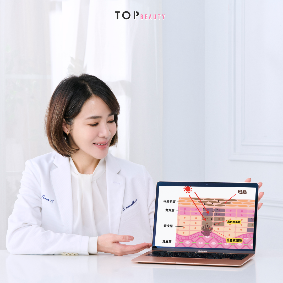 色斑種類與成因眾多！而紫外線損害就是其中之一，也是最多人受影響的原因！ 