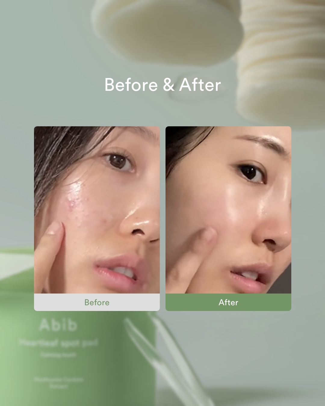 有效改善發熱泛紅肌,改善痘痘肌。