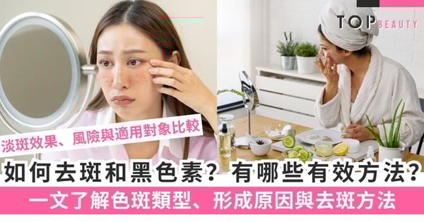 【淡斑攻略】如何去斑和黑色素?色斑類型、形成原因與有效的去斑方法