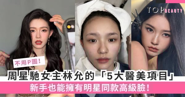 不用P圖！周星馳女主林允親證有效的「5大醫美項目」，新手也能擁有明星同款高級臉！