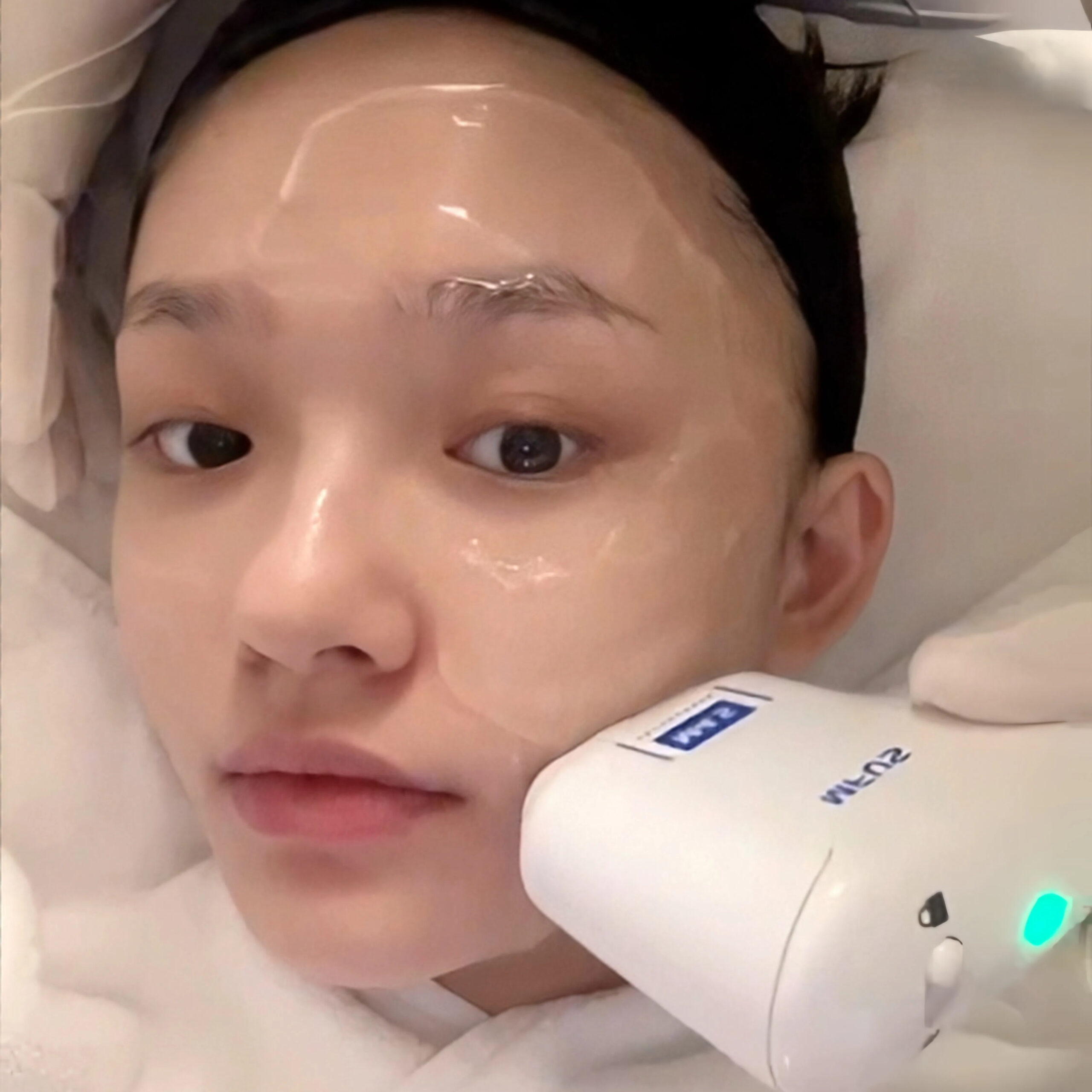 林允第一次做超聲炮時的分享。