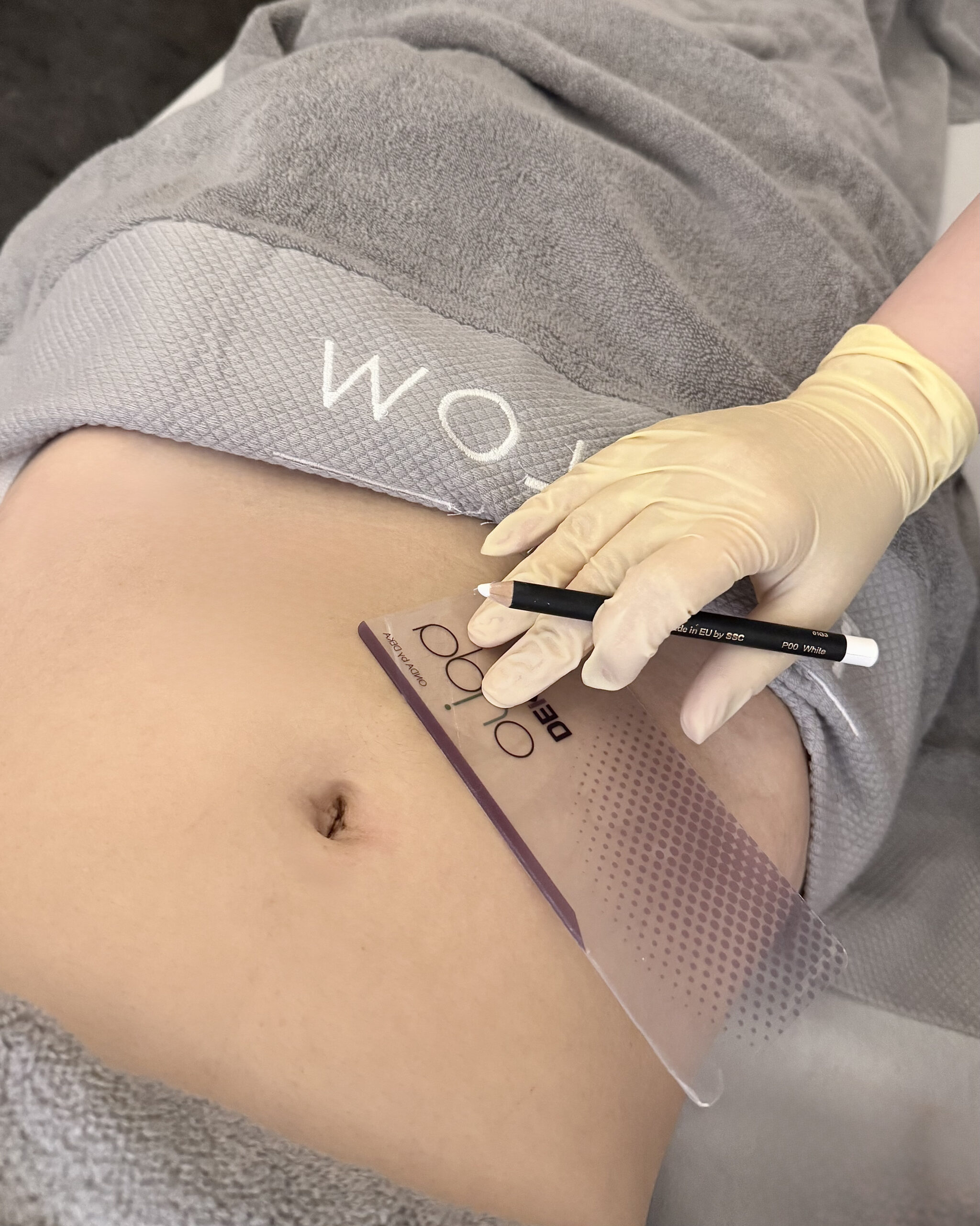 針對手臂、腰側這些鬼鼠肉，用科技輔助減脂更有效。