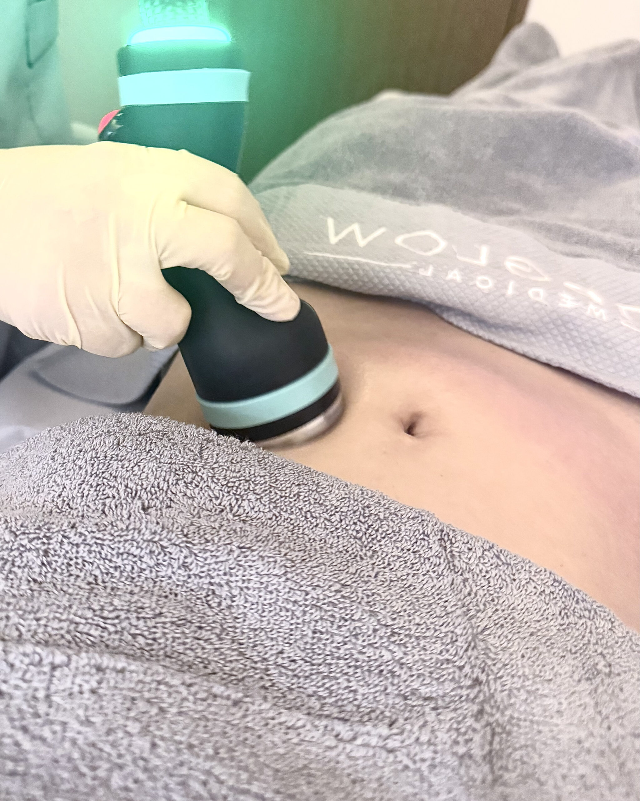 溶脂效果最好的「冷微波溶脂技術」