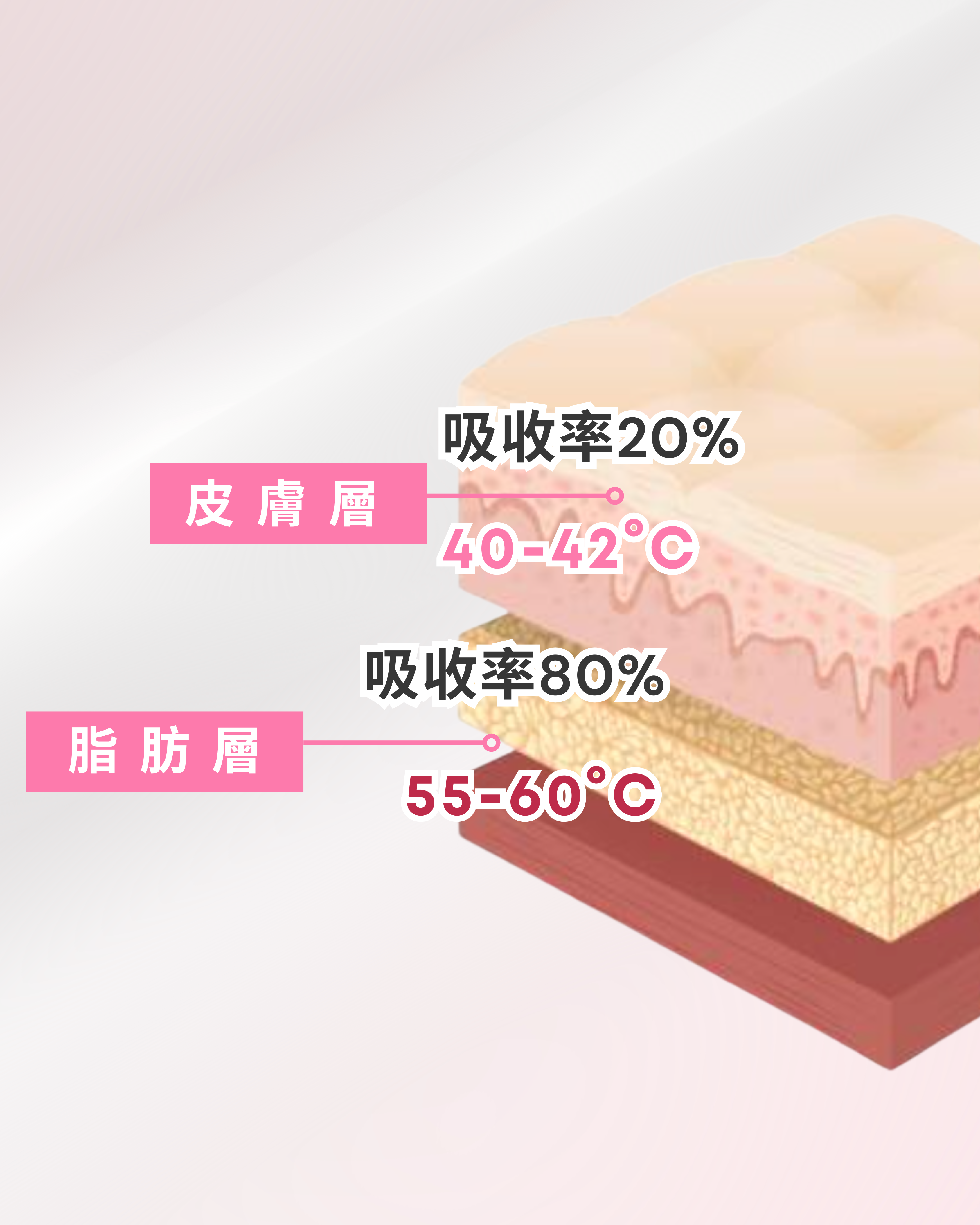 「冷微波溶脂」可以高效減脂+精緻塑形，即使沒時間運動也能瘦。