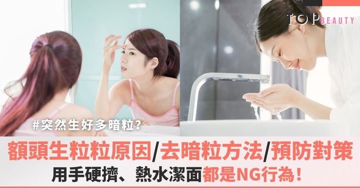 【額頭暗粒】額頭生粒粒原因＋去暗粒方法＋預防方法重點整理！用手硬擠、熱水潔面都是NG行為！