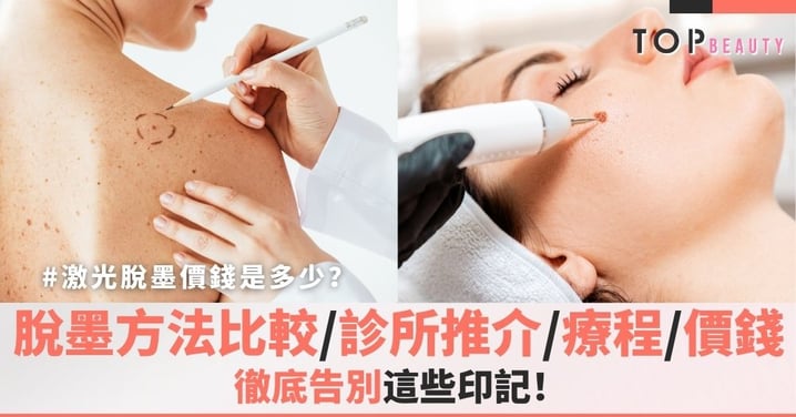 【激光脫墨】脫墨邊間好？激光脫墨價錢是多少？一文看清脫墨方法比較＋脫墨推介＋脫墨療程＋常見問題解答