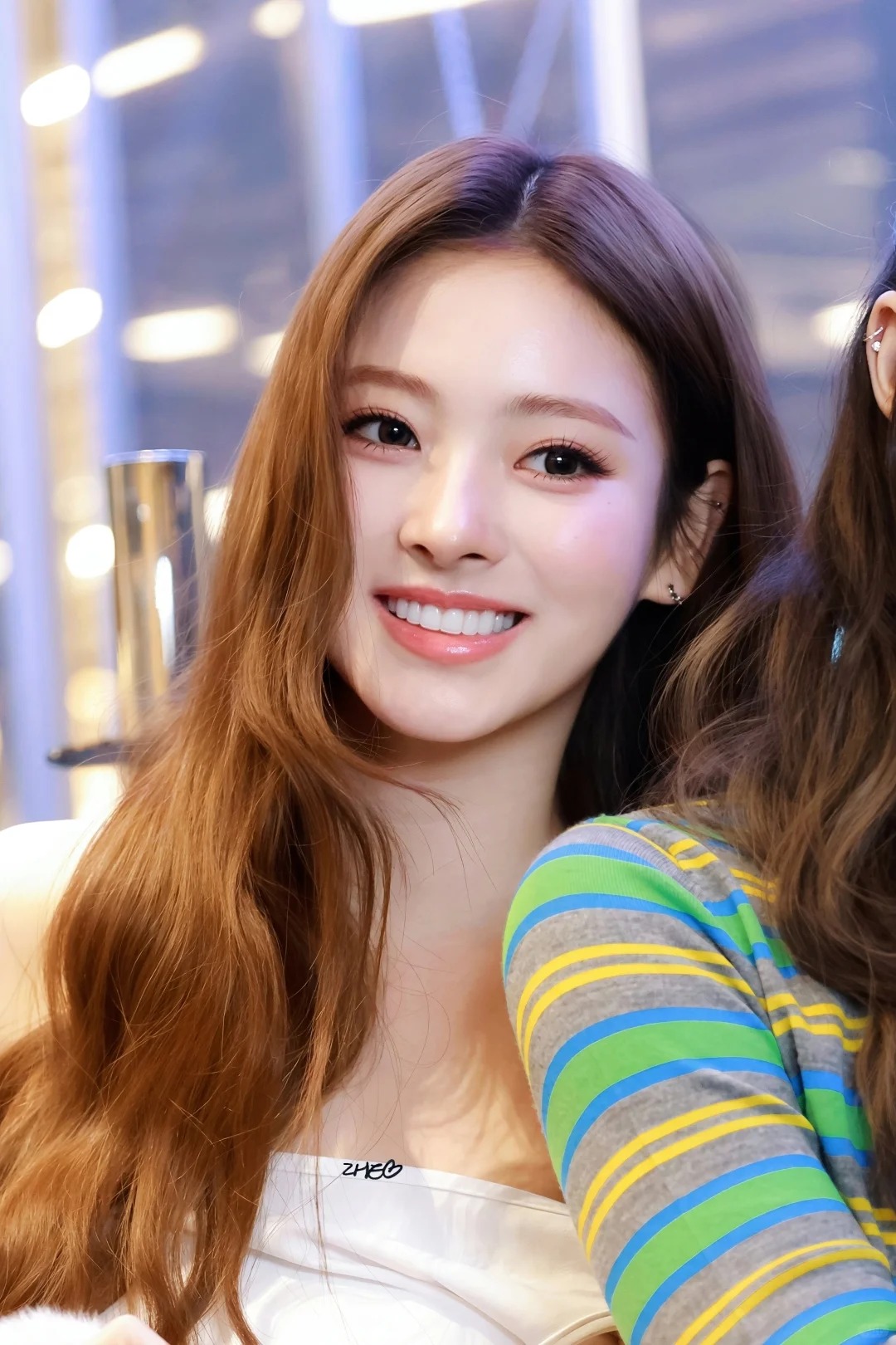 「牙貼片」可以讓牙齒的顏色、形狀、大小和排列感大幅升級。