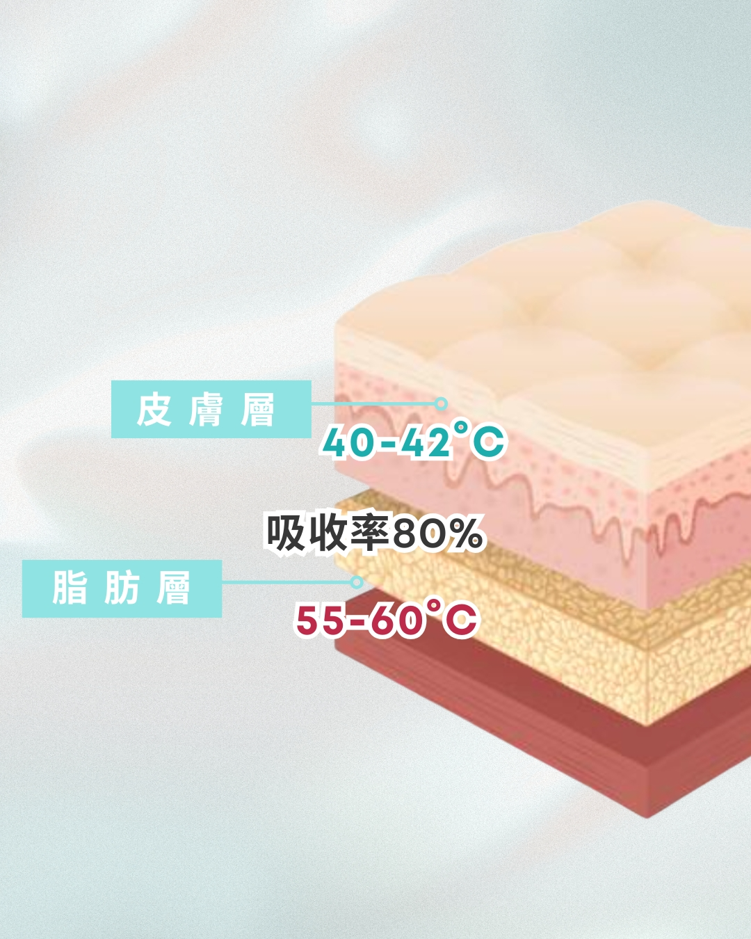 透過加熱脂肪層到55°C來消滅老化的脂肪，起到減脂效果。