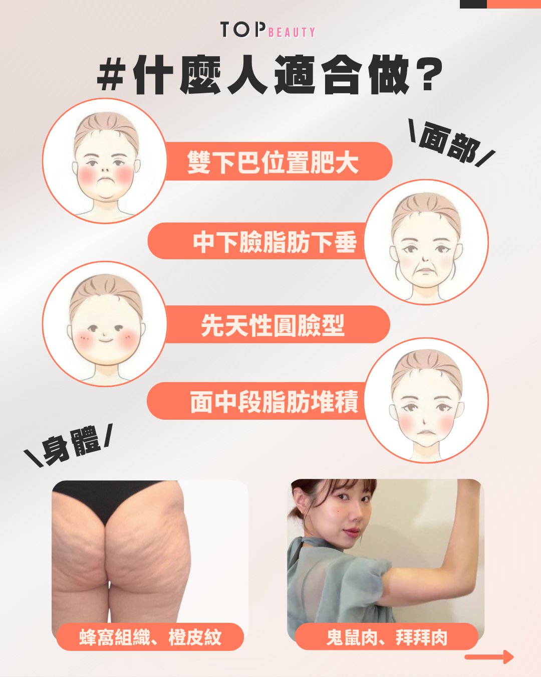 被消滅的脂肪不會再增生，長期堅持可以保持輪廓線條和達到瘦面效果。