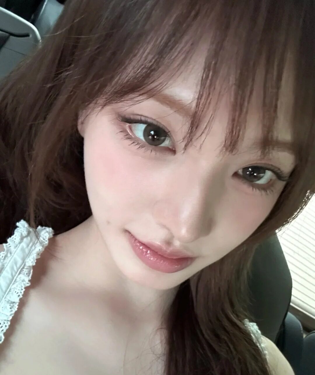 嘴角痣