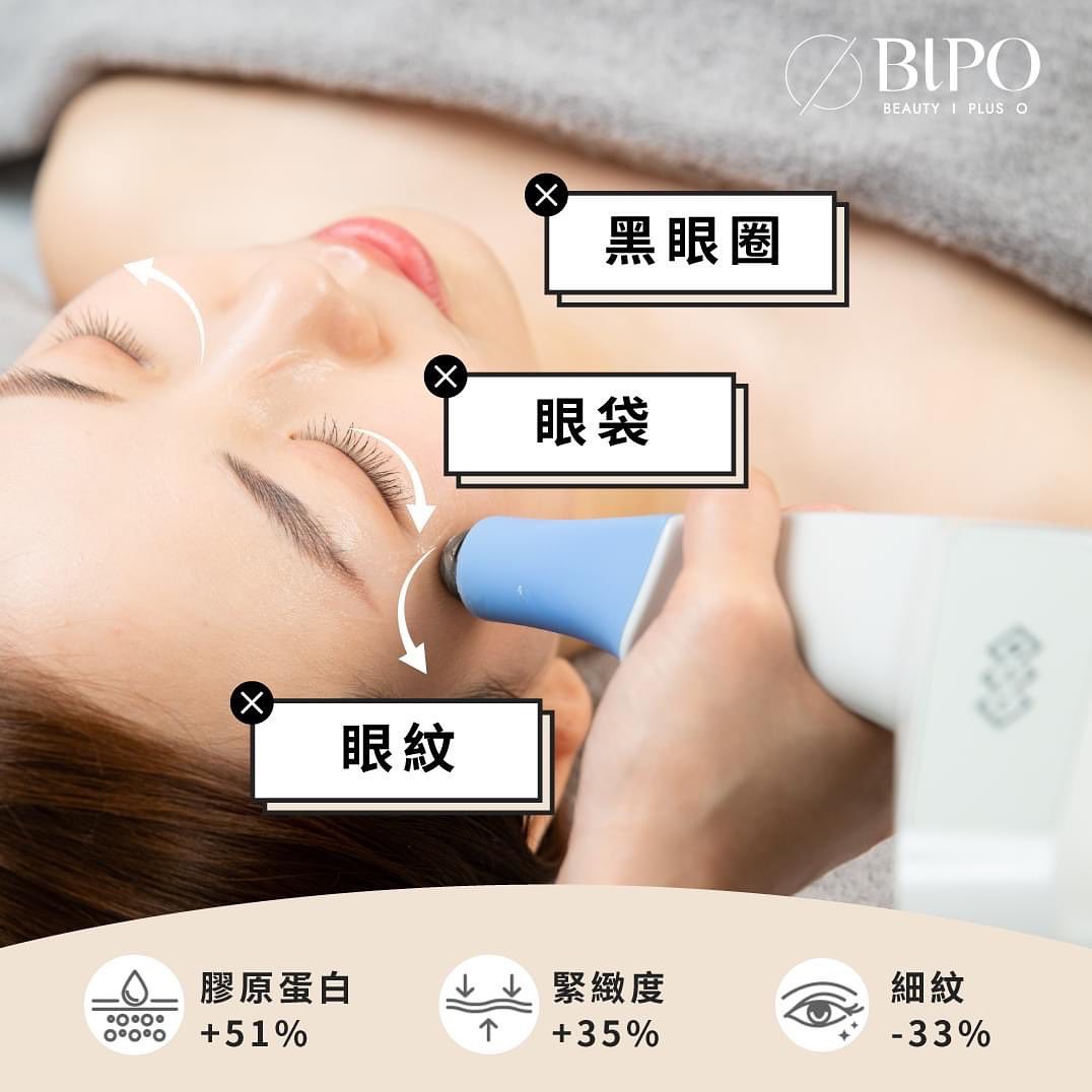 BIPO Exilis Ultra 360眼部緊緻提升療程。