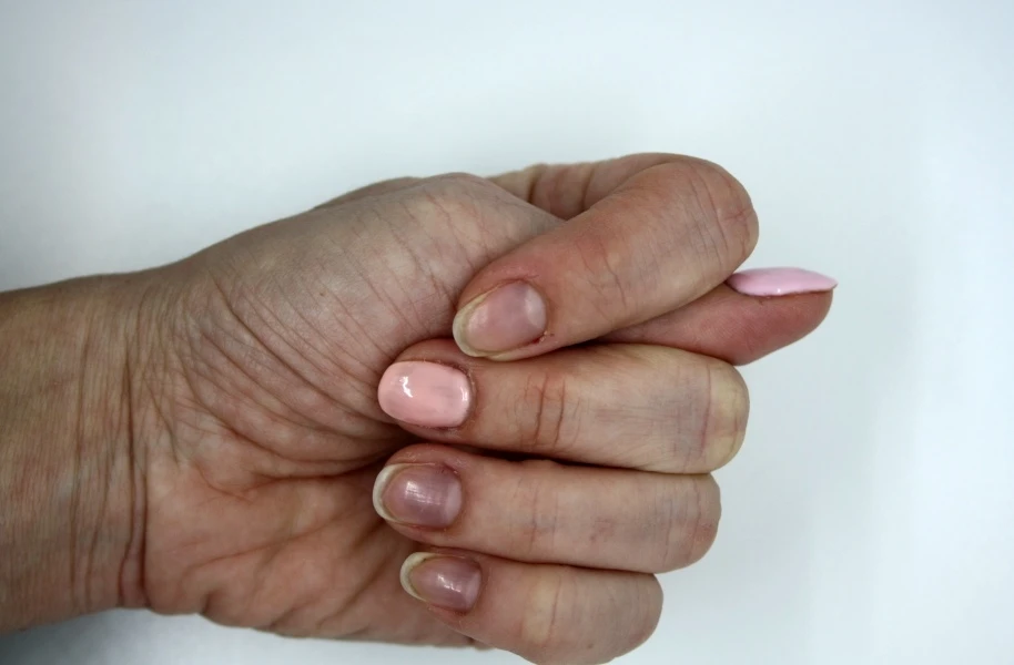 異常的紫色或青紫色需要特別留意。