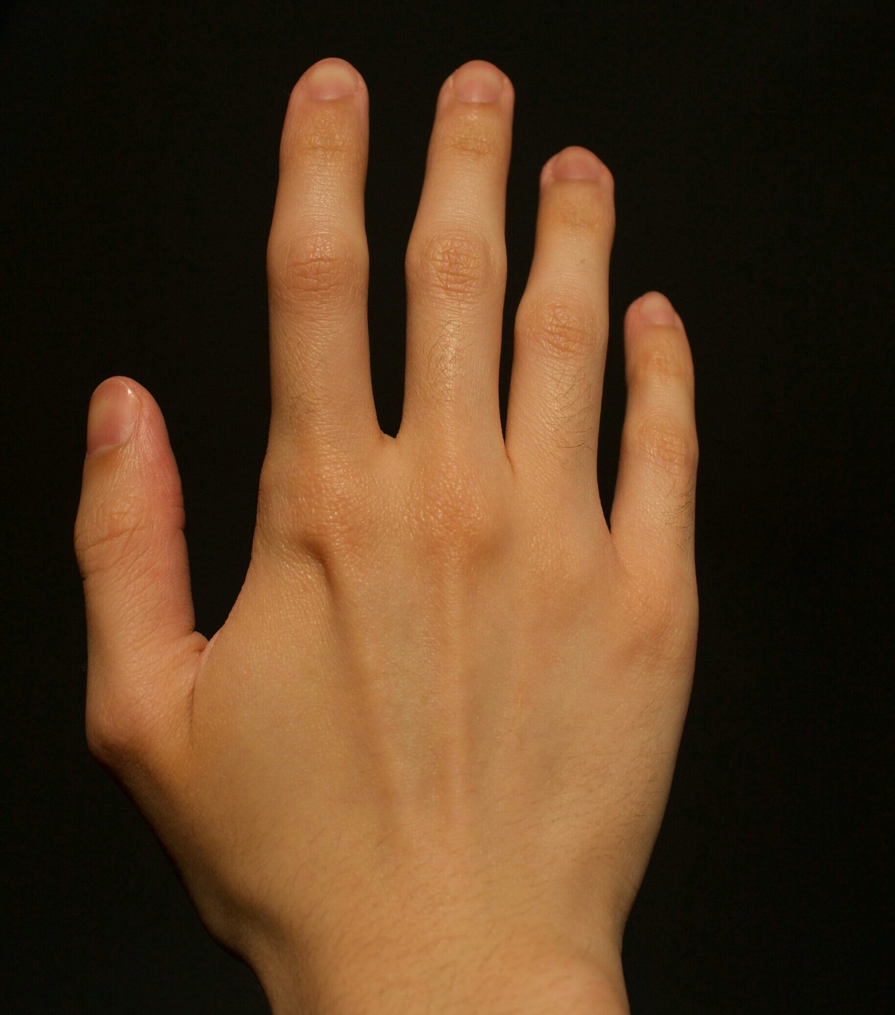 指甲的顏色變是身體發出的信號。