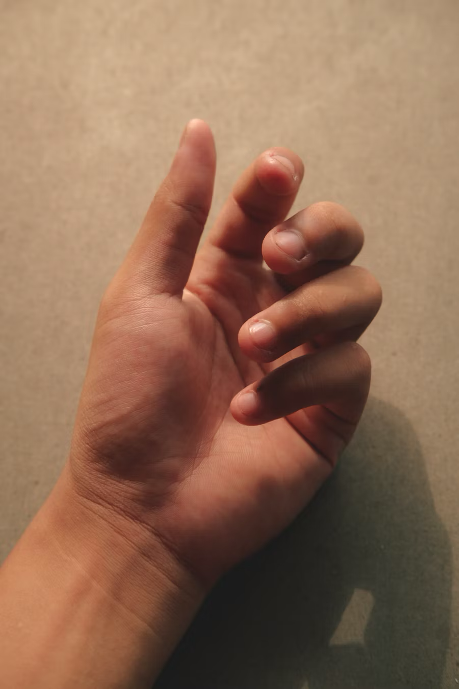 指甲變色的原因