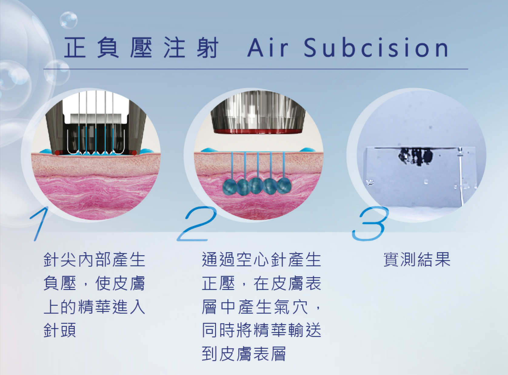 療程透過獨家正負壓技術，將精華液瞬間推送至肌底。