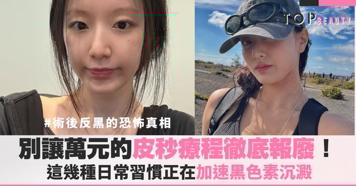 別讓萬元的皮秒療程徹底報廢!術後反黑的恐怖真相,這幾種日常習慣正在加速黑色素沉澱