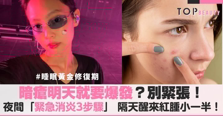 暗瘡明天就要爆發？別緊張！夜間「緊急消炎3步驟」，隔天醒來紅腫小一半！