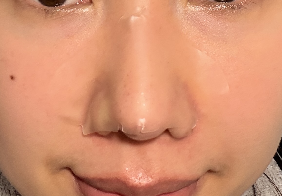貼上鼻貼