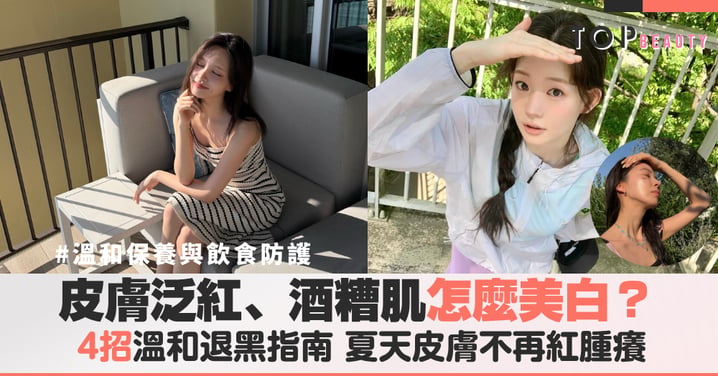酒糟肌怎麼美白？4招溫和退黑指南，防曬與飲食調整步驟一次看，夏天皮膚不再紅腫癢