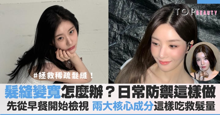 髮縫變寬怎麼辦？從檢視你的早餐開始，兩大核心成分這樣吃救髮量