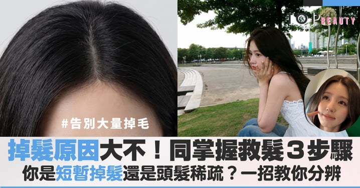 掉髮原因大不同！你是短暫掉毛還是頭髮稀疏？一招教你分辨，視覺增量技巧大公開