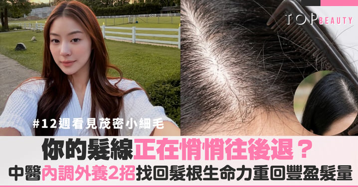 髮線退後怎麼辦？中醫內調外養兩大招找回髮根生命力