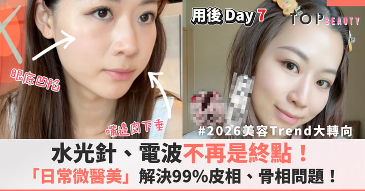 【2026美容Trend大轉向】無需10+項療程！「日常微醫美」極簡2步把醫美Concept搬回Daily Routine，一舉解決99.9%皮相、骨相問題
